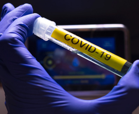 Facciamo i conti con Covid